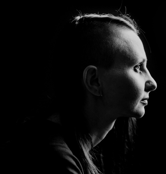 Black and white image of an actor portrayal of Trudhesa patient looking to right profile with partial shaved head